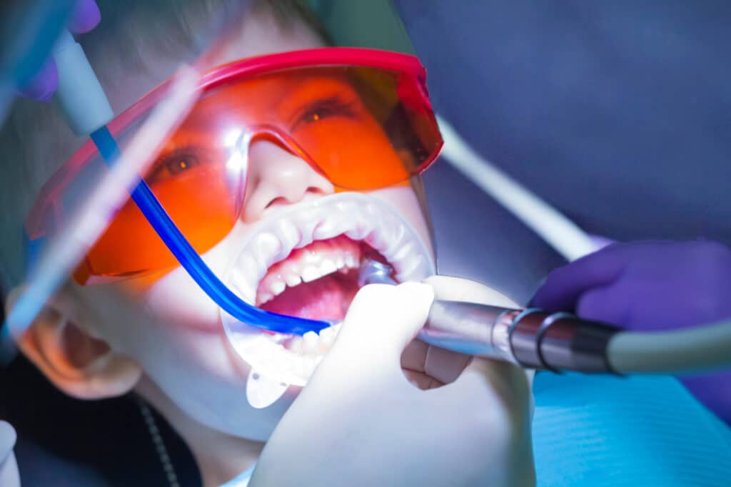 Laser Dentistry Rigby